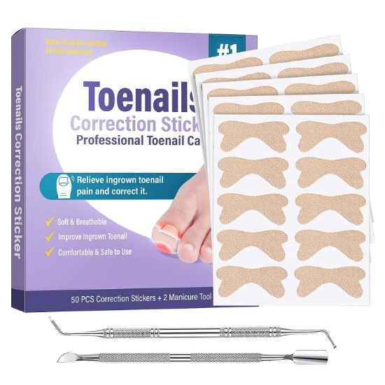 Ingrown Toenail Treatment, 50Pcs Ingrown Toenail Corrector Strips, Professional & Safe & Efficient &Painless ingrown toenail tool with 2 professional pedicure tools Suitable for All Nail Sizes